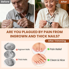 LIONVISON non-slip ergonomic handles aid comfortable use for arthritic hands.