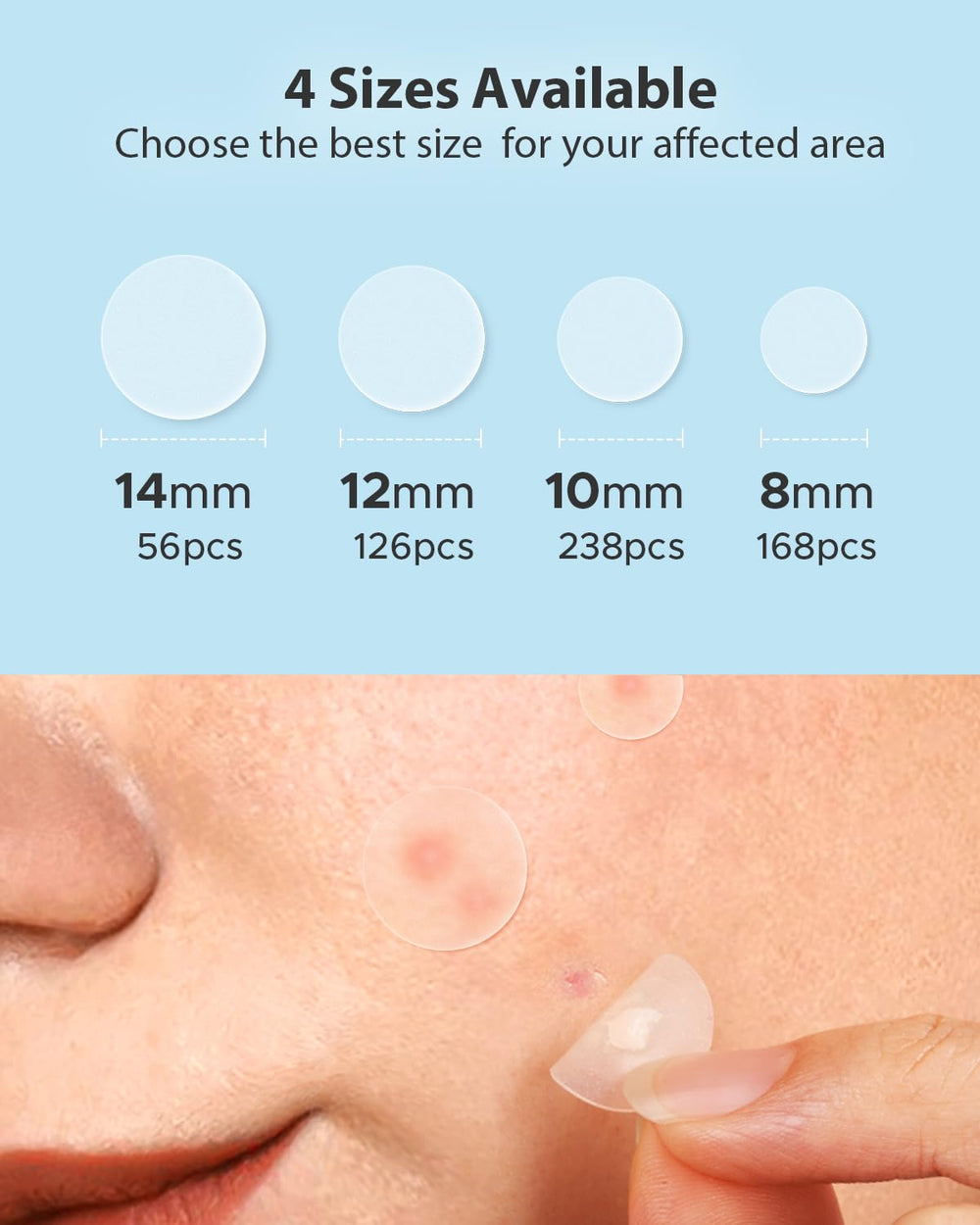 LitBear 12mm patch on face; versatile coverage for larger pimples.