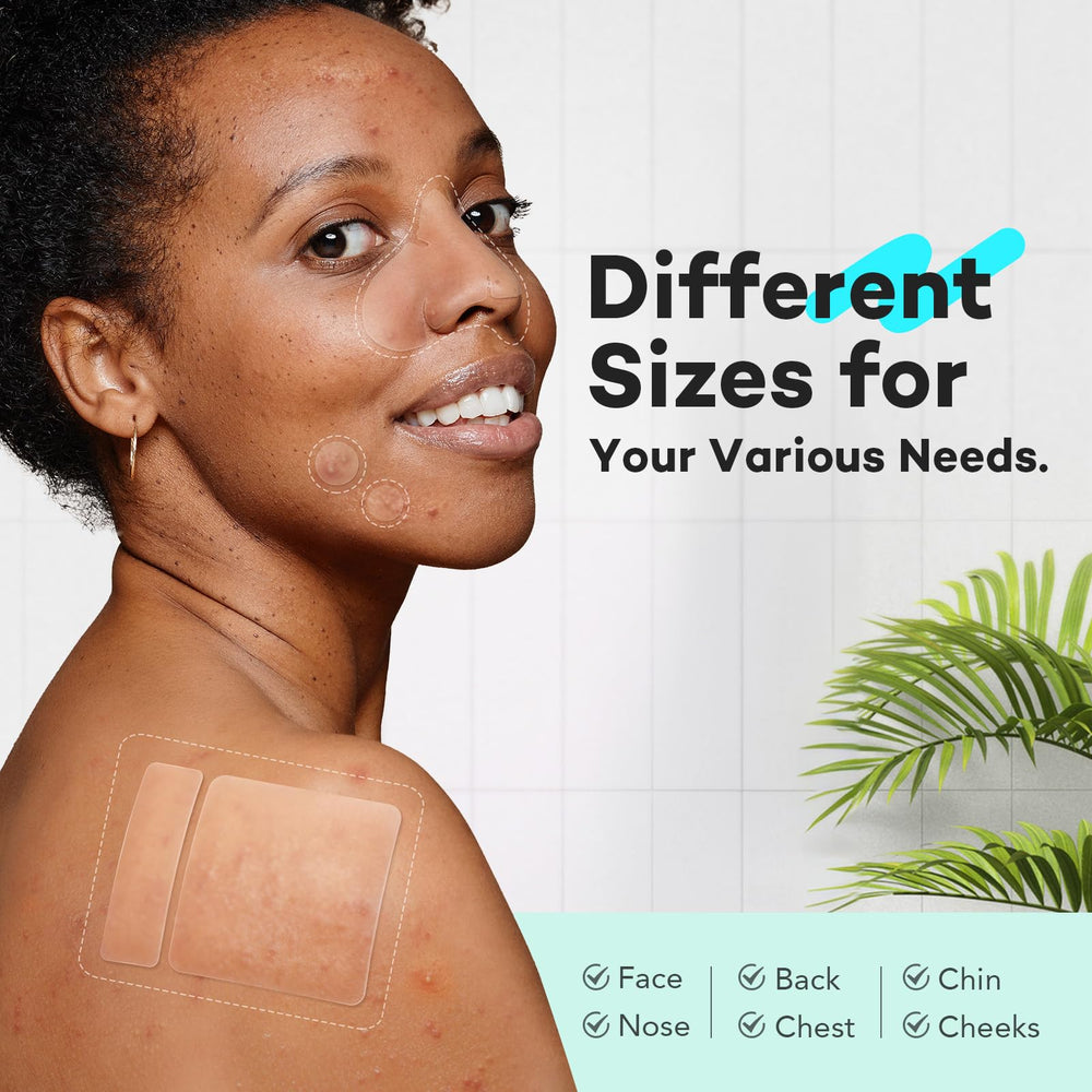 LitBear pimple patch 12mm spot targets mid-sized zits with gentle healing support.