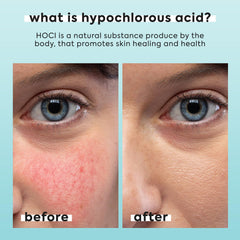 LivaClean hypochlorous spray fine mist demonstrates even application for daily refresh