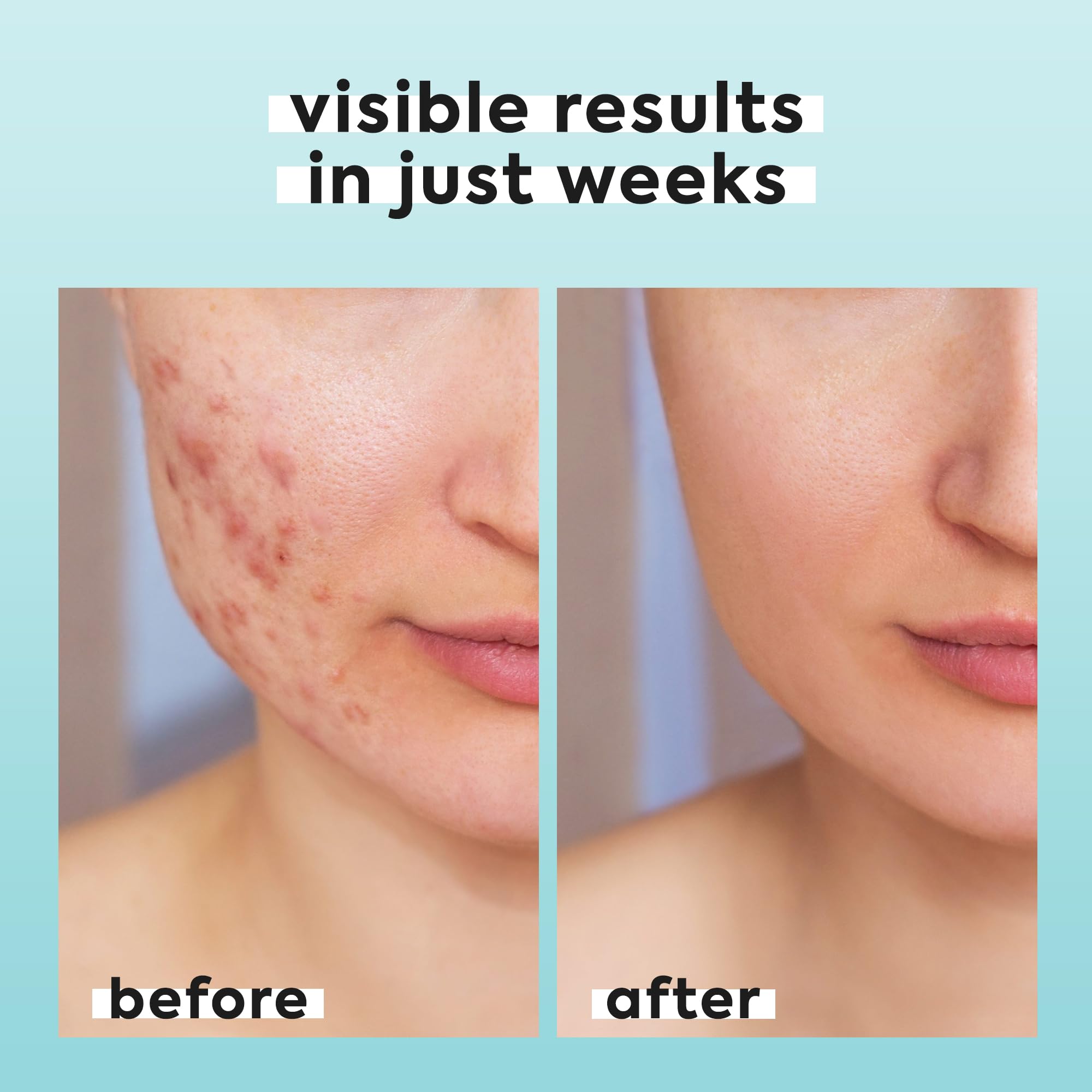 LivaClean hypochlorous spray travel-size ideal for on the go skincare
