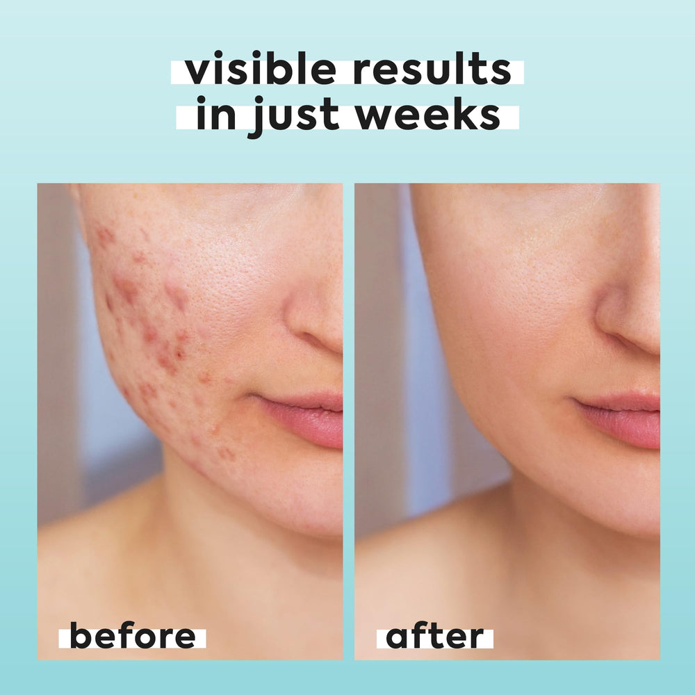 LivaClean hypochlorous spray travel-size ideal for on the go skincare