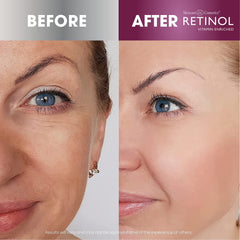 Livaura creamy texture on hand illustrates non-greasy hydration