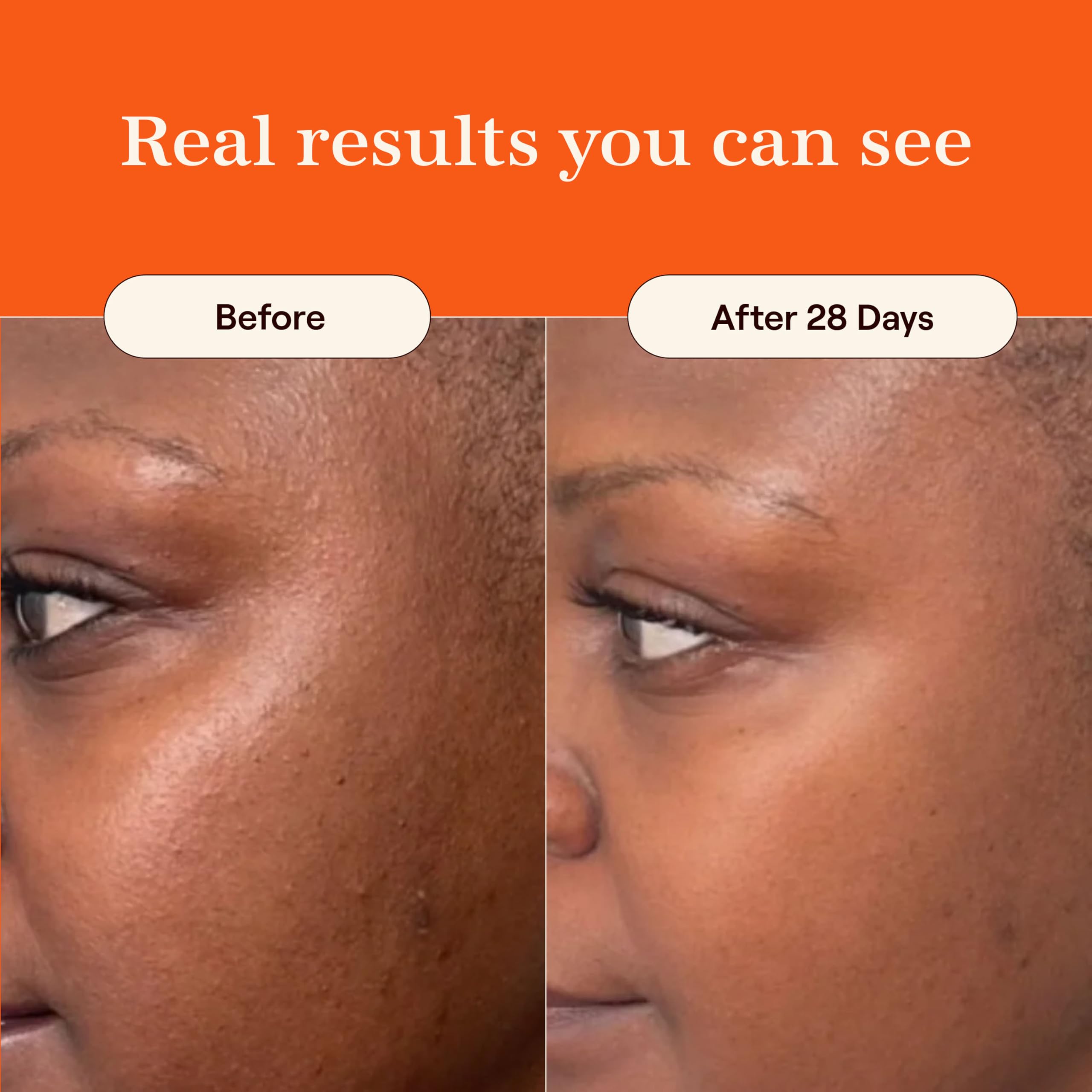 Live Tinted Superhue Serum Stick on face and body for consistent glow and even tone