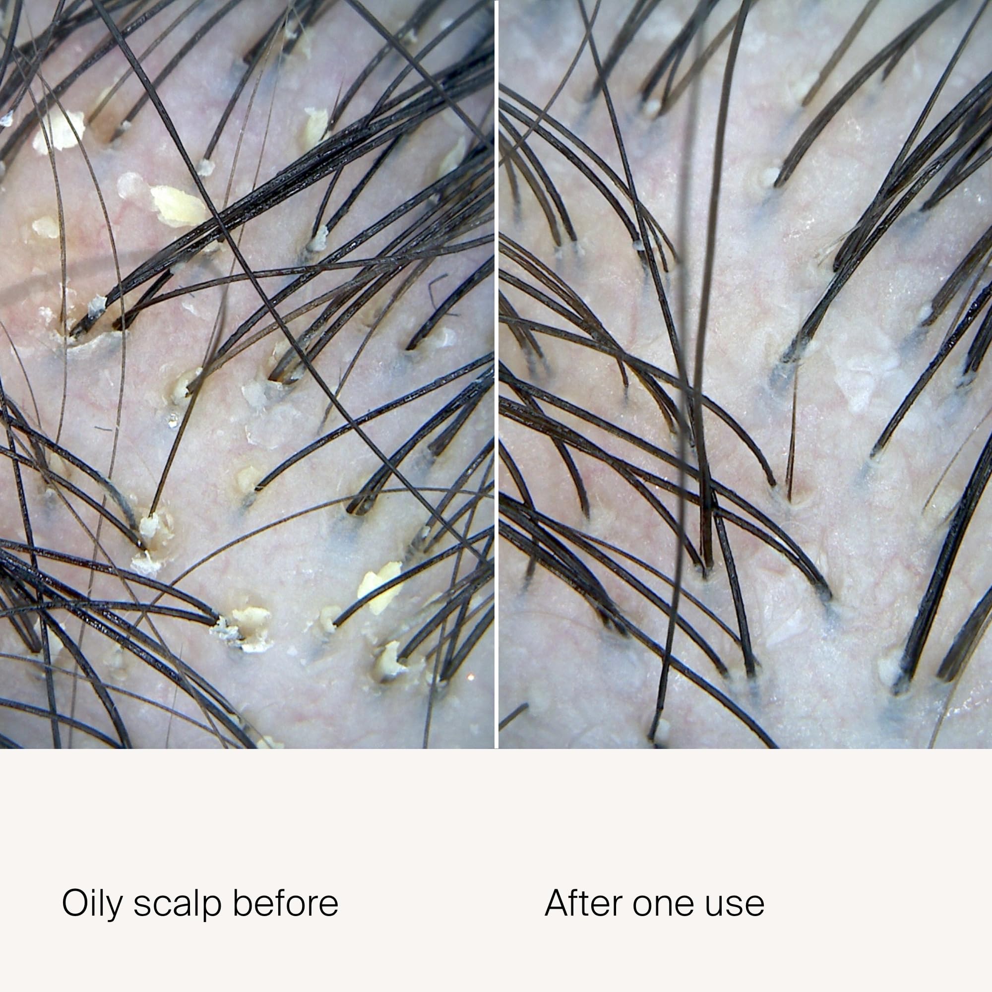 Living Proof Scalp Exfoliator direct-tip applicator enables precise, mess-free scalp treatment