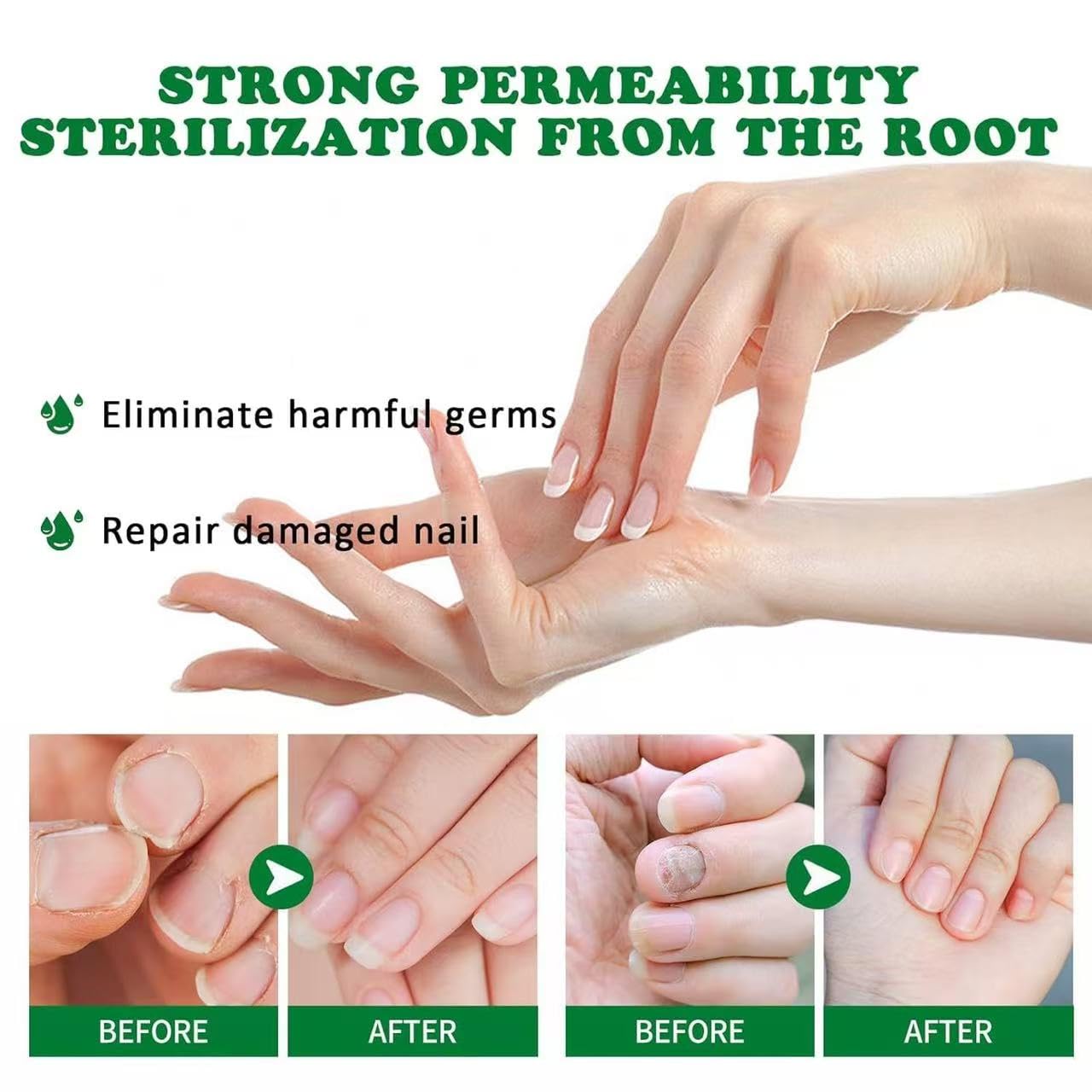 Lmoy two-pack nail repair set highlights value and convenience for routine maintenance.