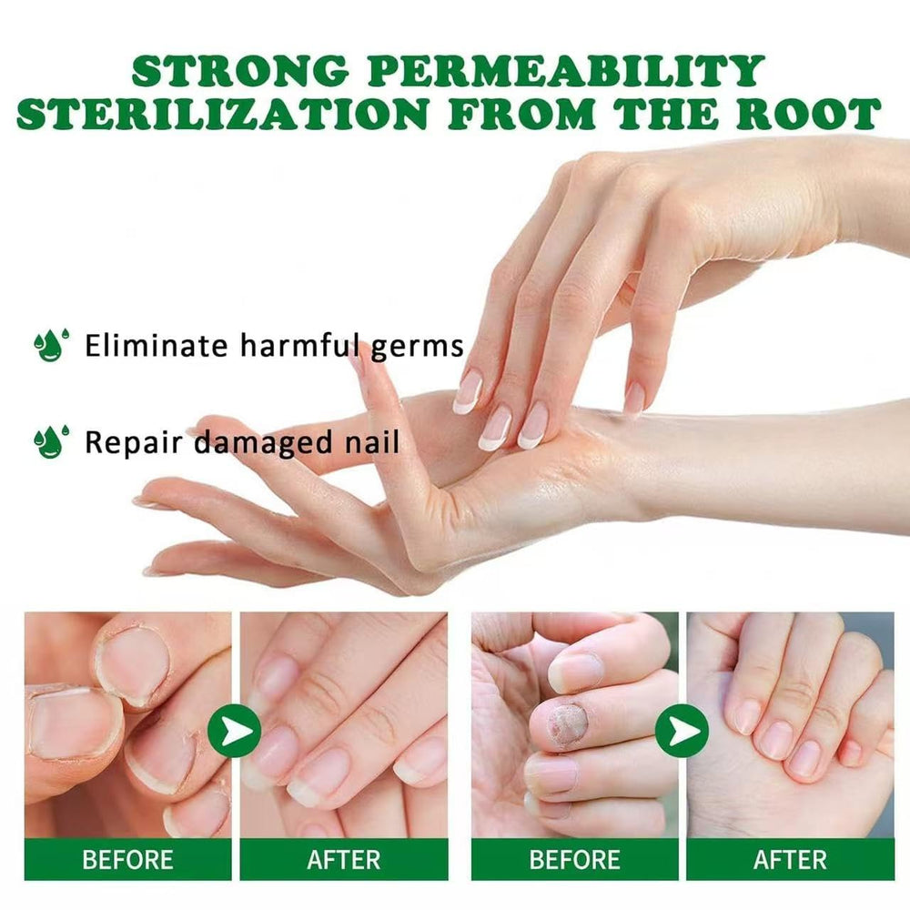 Lmoy two-pack nail repair set highlights value and convenience for routine maintenance.