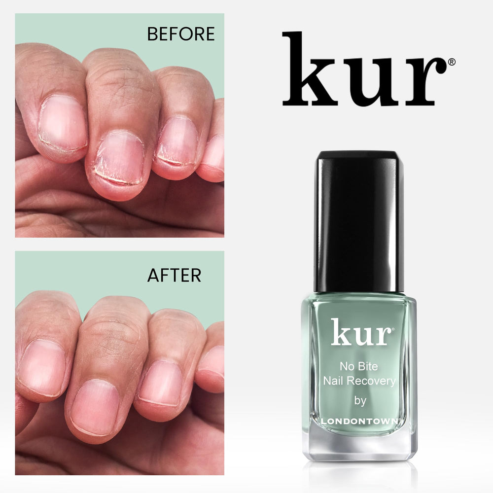 LONDONTOWN No Bite Nail Recovery bottle top shows secure, mess-free dosing.