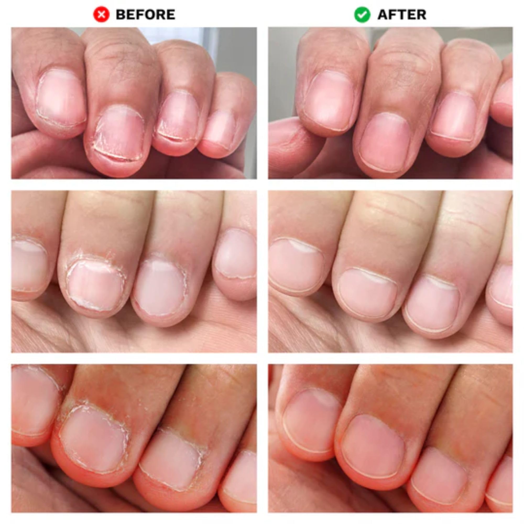 LONDONTOWN No Bite Nail Recovery packaging label highlights key benefits.