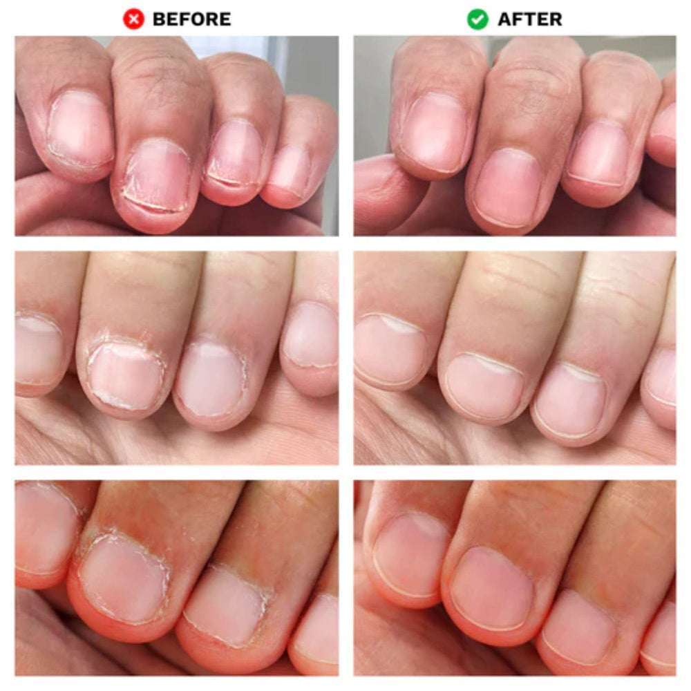 LONDONTOWN No Bite Nail Recovery packaging label highlights key benefits.