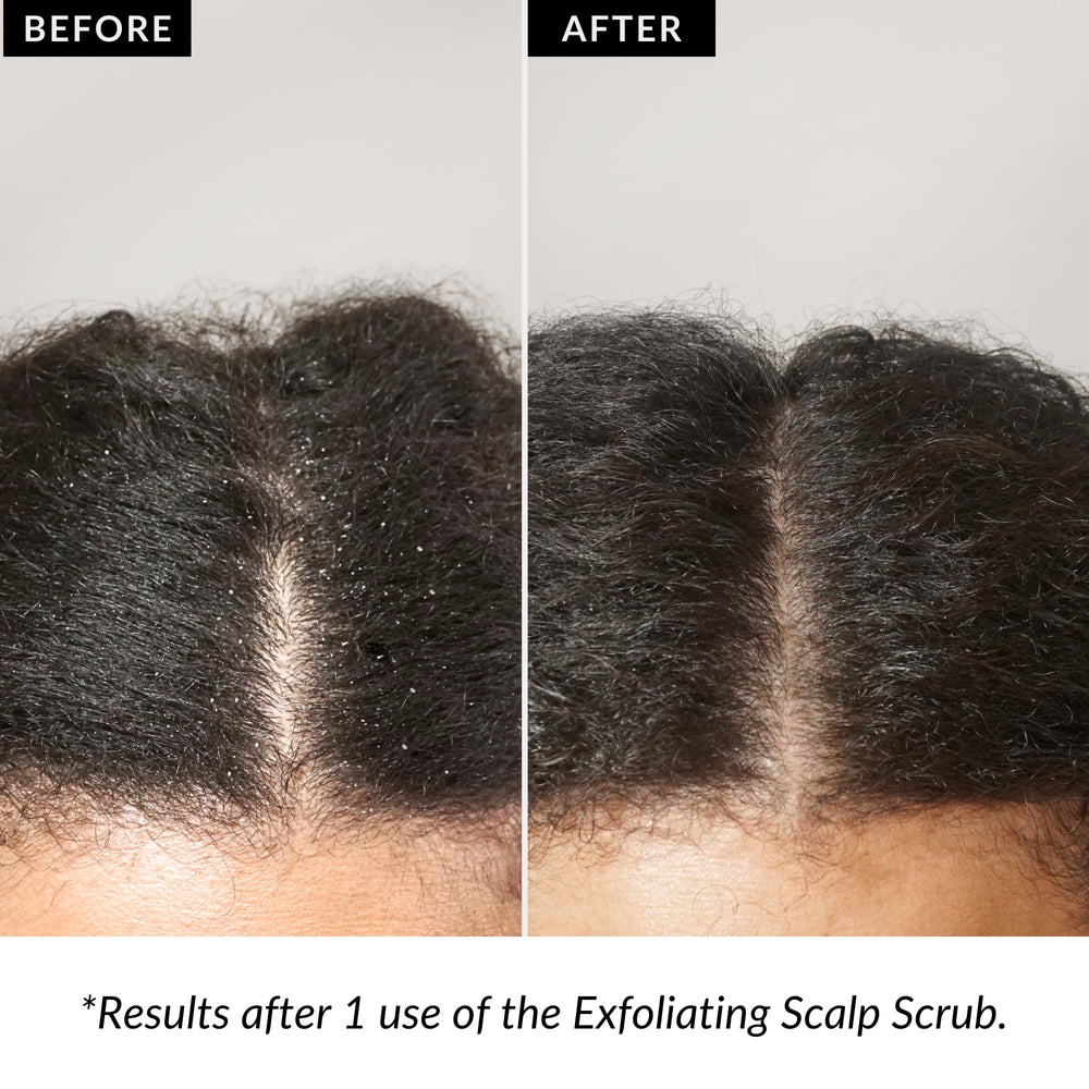 Love Ur Curls Exfoliating Scalp Scrub used pre-shampoo for better absorption