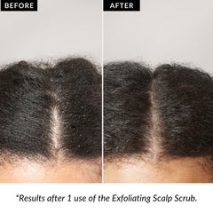 Love Ur Curls Exfoliating Scalp Scrub used pre-shampoo for better absorption