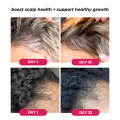 Love Ur Curls scalp serum drop dispense close-up highlights precise scalp care