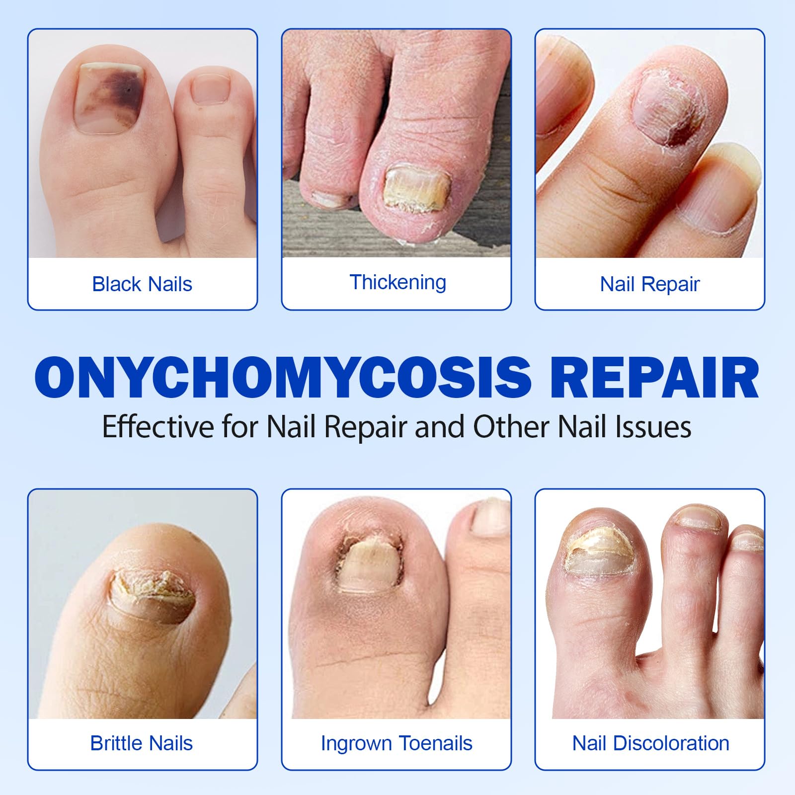 LTQXGT nail repair glue application closeup showing strong bond