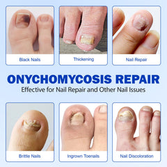 LTQXGT nail repair glue application closeup showing strong bond