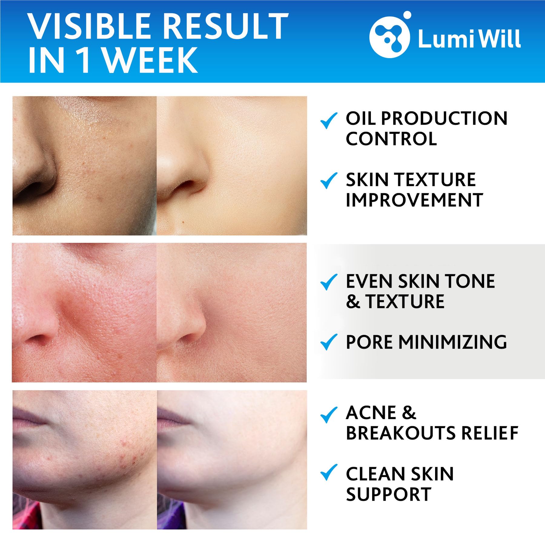 LUMI WILL glycolic pad ingredients with vitamins C and E for skin nourishment