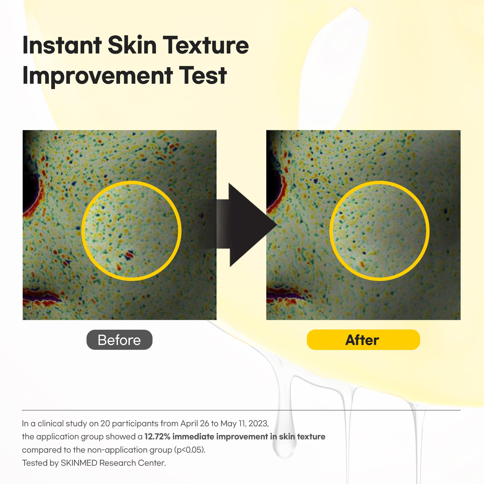 Hydrogel texture stays comfortable while delivering nourishment