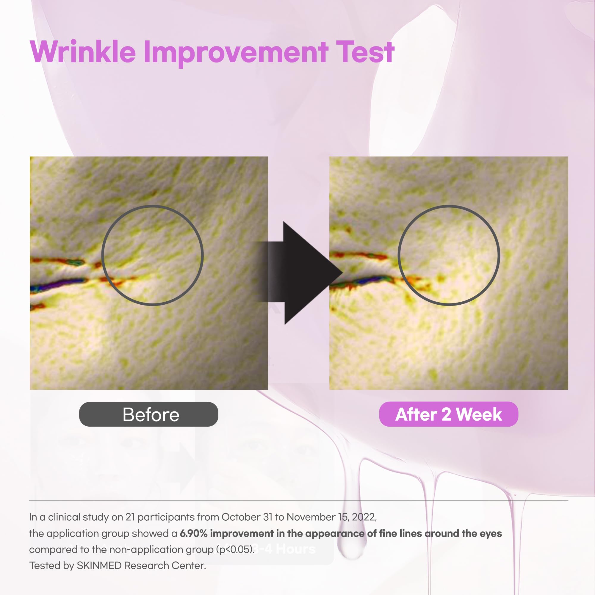 LUVUM hydrogel texture transforms from opaque to translucent during absorption