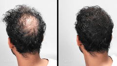 LUXE Hair Building Fibers provide a natural look and fullness for thinning hair.