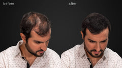 LUXE Hair Building Fibers withstand wind to maintain natural look.