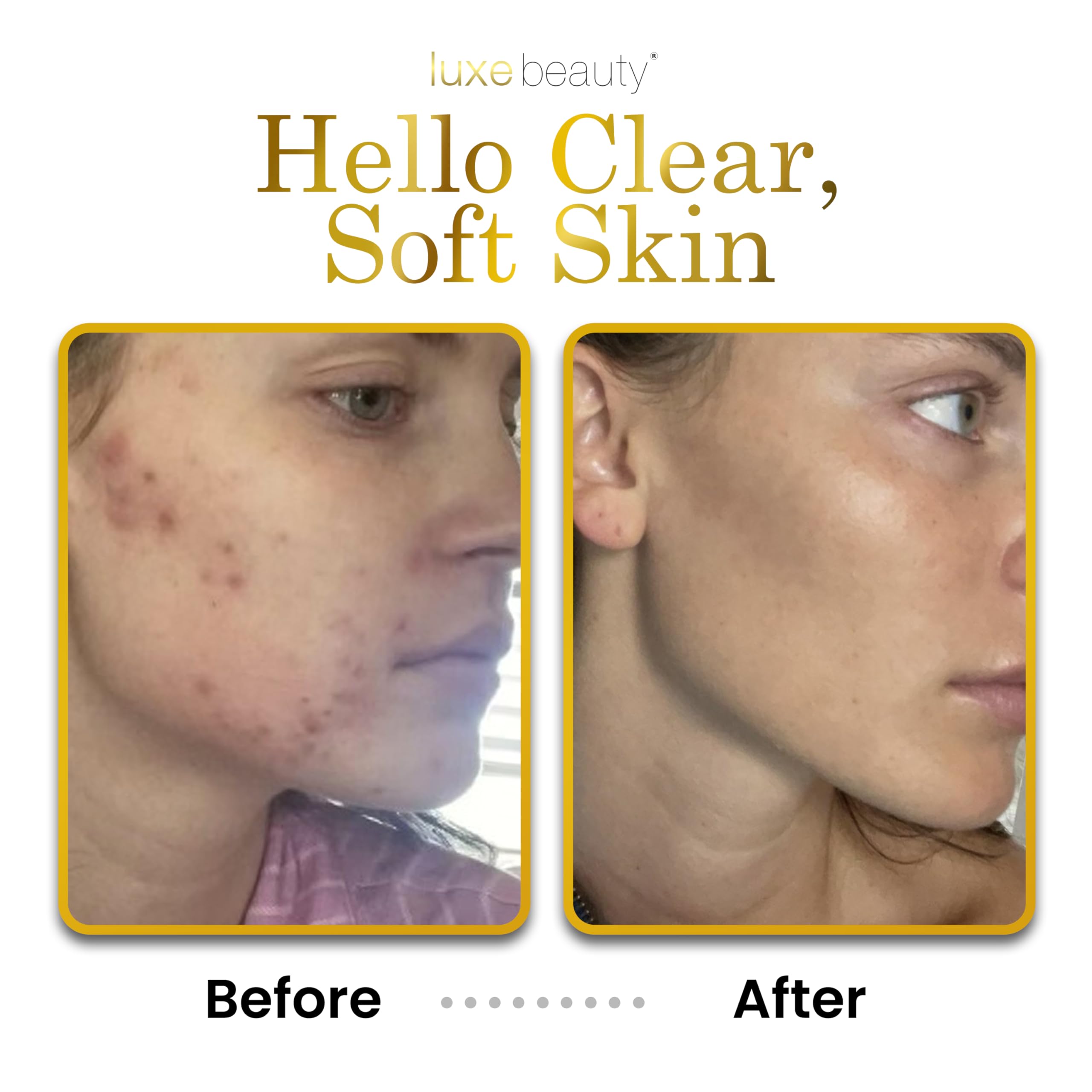 LUXELOTION ingredients-raspberry-seed-oil closeup signals nourishing antioxidant care