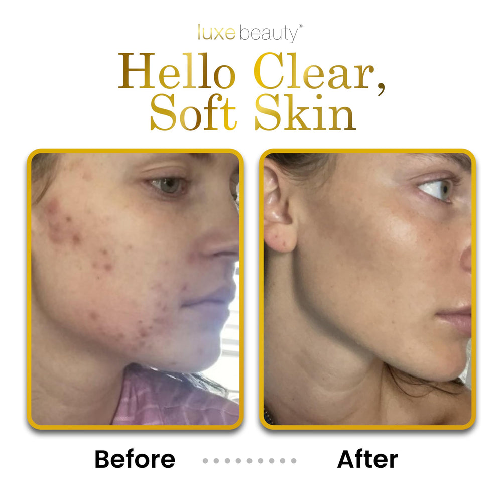LUXELOTION ingredients-raspberry-seed-oil closeup signals nourishing antioxidant care
