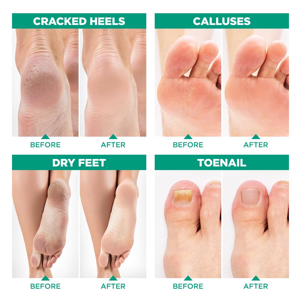 LV LavinsO foot soak odor-control helps fresh feet throughout the day