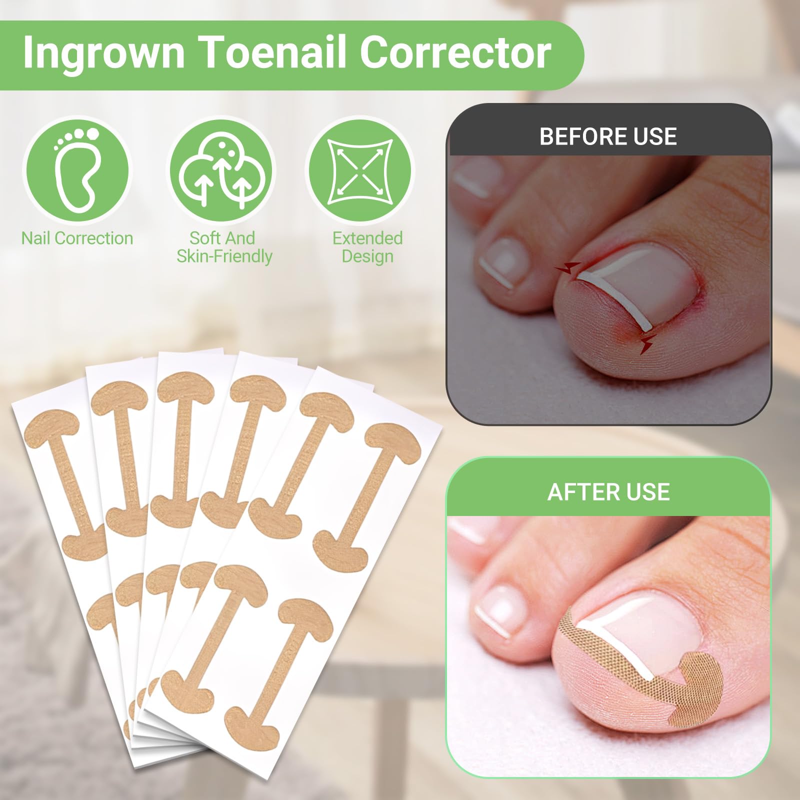 LYNRUI easy-use corrector patches support gentle nail growth guidance.