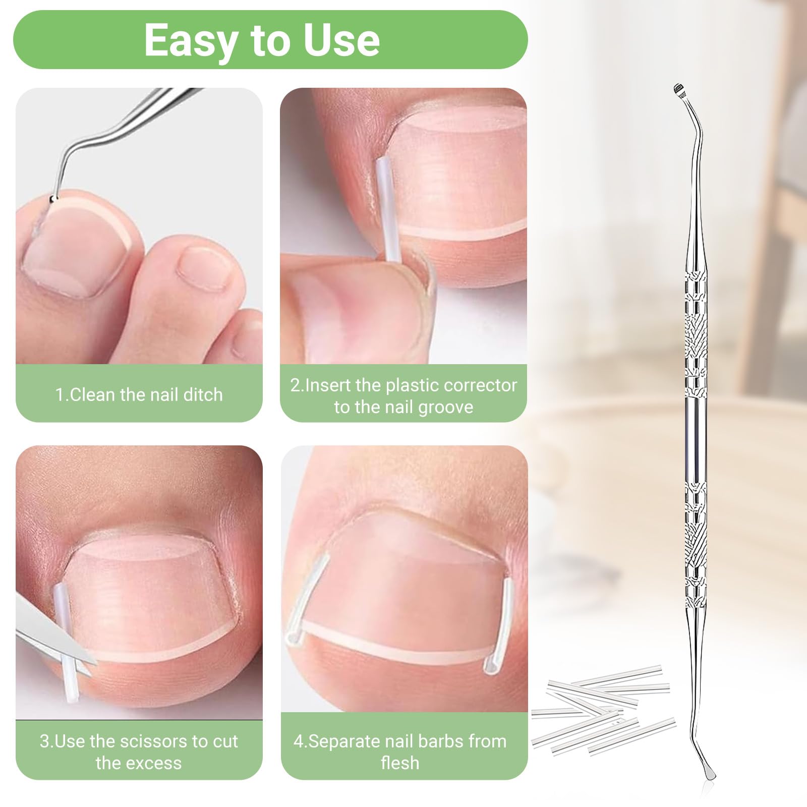 LYNRUI nail file and lifter tools help precise trimming before treatment.