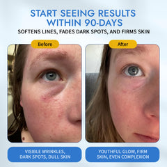 MAELOVE Moonlight Serum on skin during absorption shows smoother texture.
