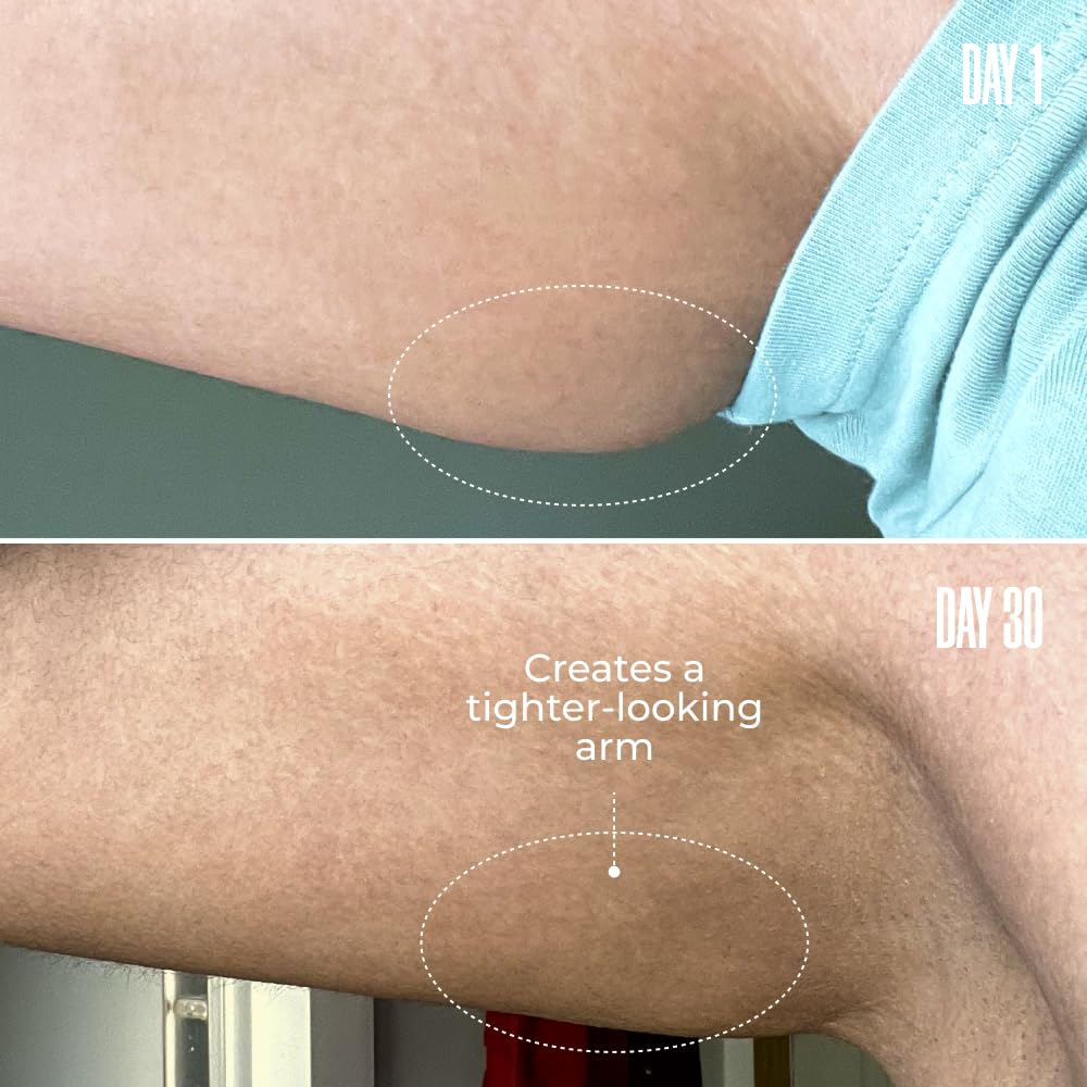 Maëlys B-FLEX arm cream on skin suggests tightening and smoother appearance