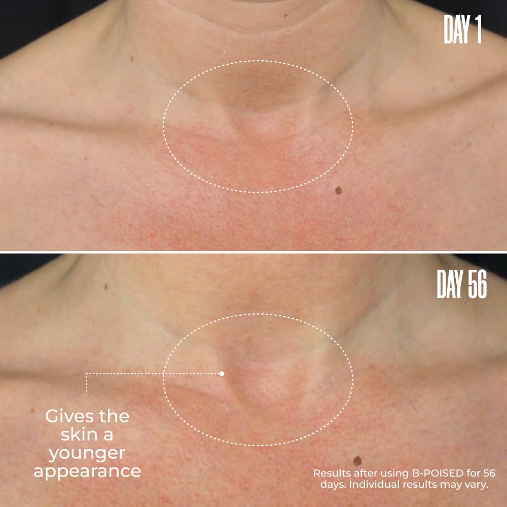 Maëlys B-Poised neck-decollete texture closeup shows smoothing.