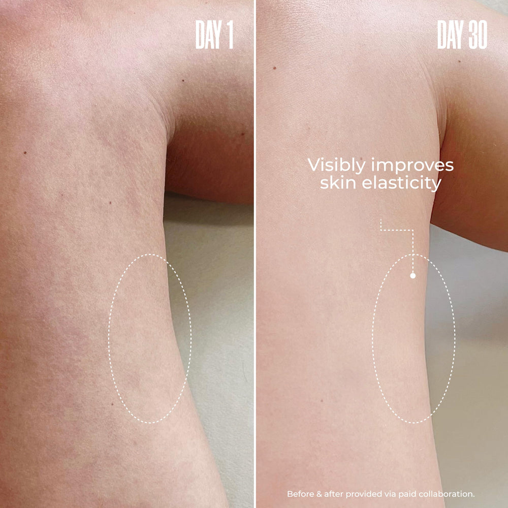 MAËLYS B-FOXY application on thigh enables easy massage and absorption.