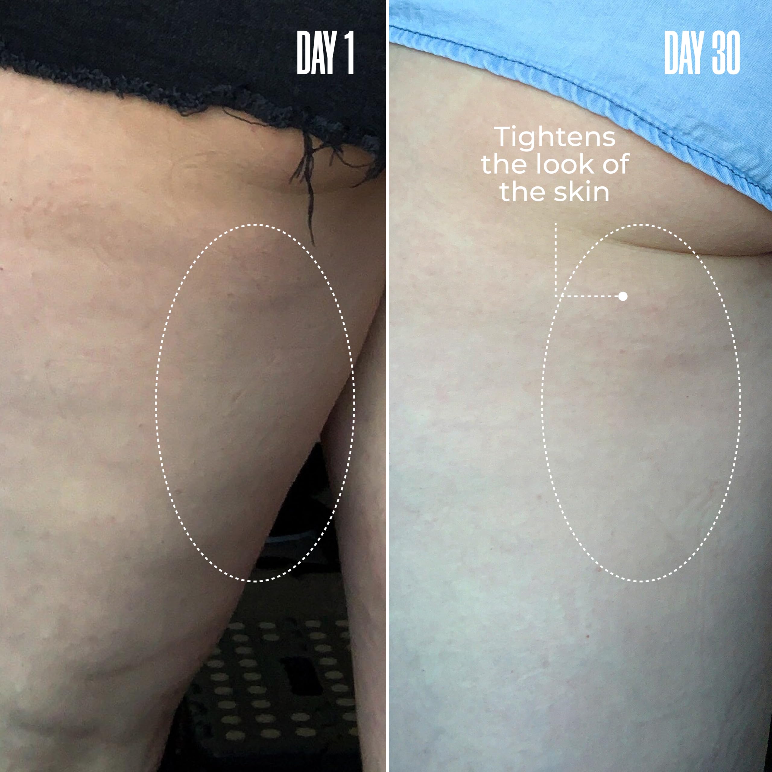 MAËLYS B-TIGHT butt-area visual suggests how the product targets that zone.