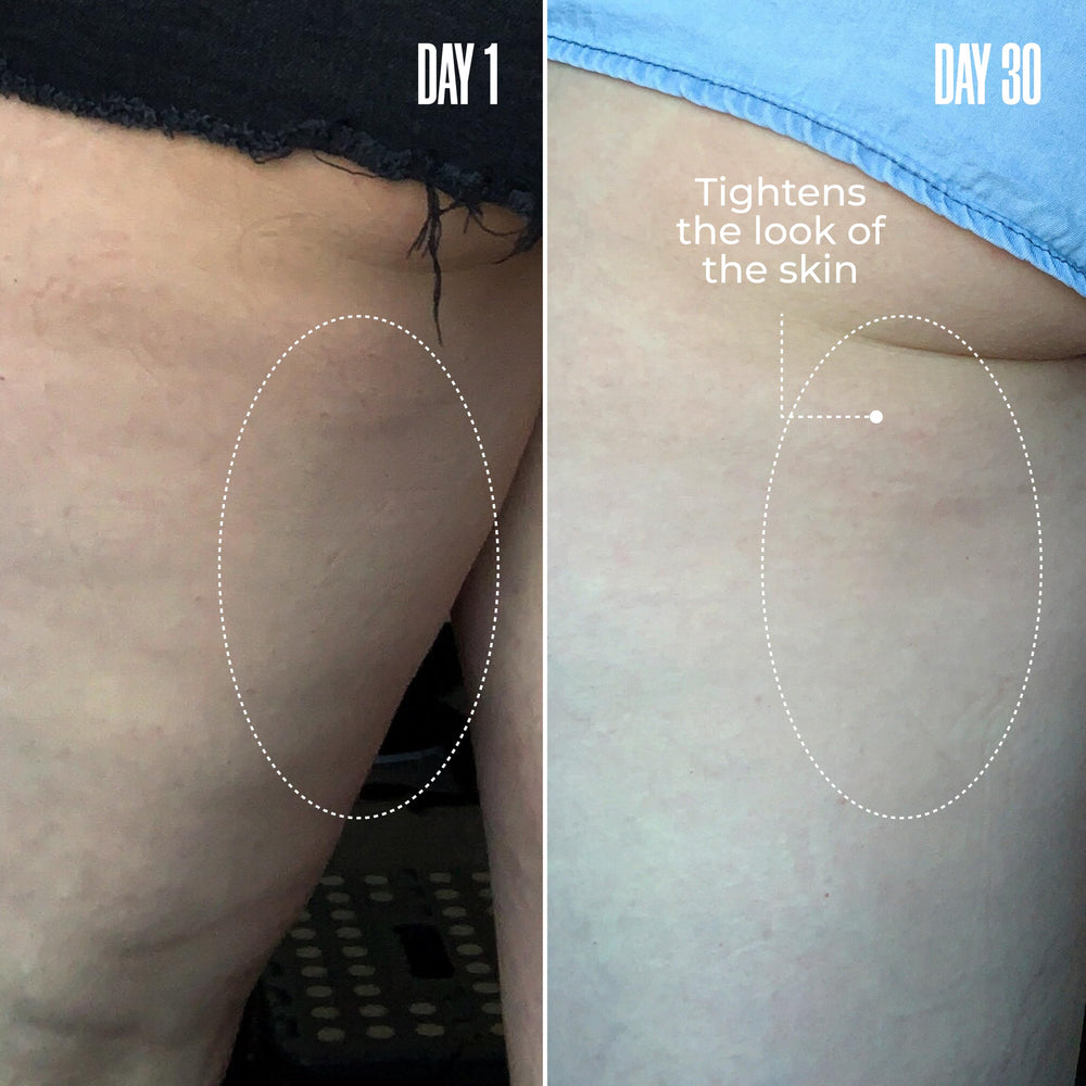 MAËLYS B-TIGHT butt-area visual suggests how the product targets that zone.