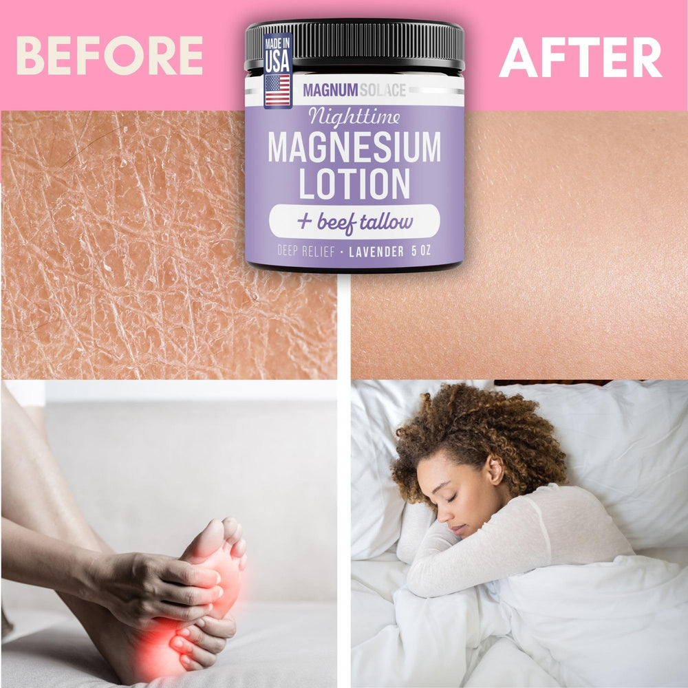 Applying Magnum Solace Nighttime Lotion to legs and feet offers comforting hydration before bed.