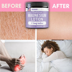 Applying Magnum Solace Nighttime Lotion to legs and feet offers comforting hydration before bed.