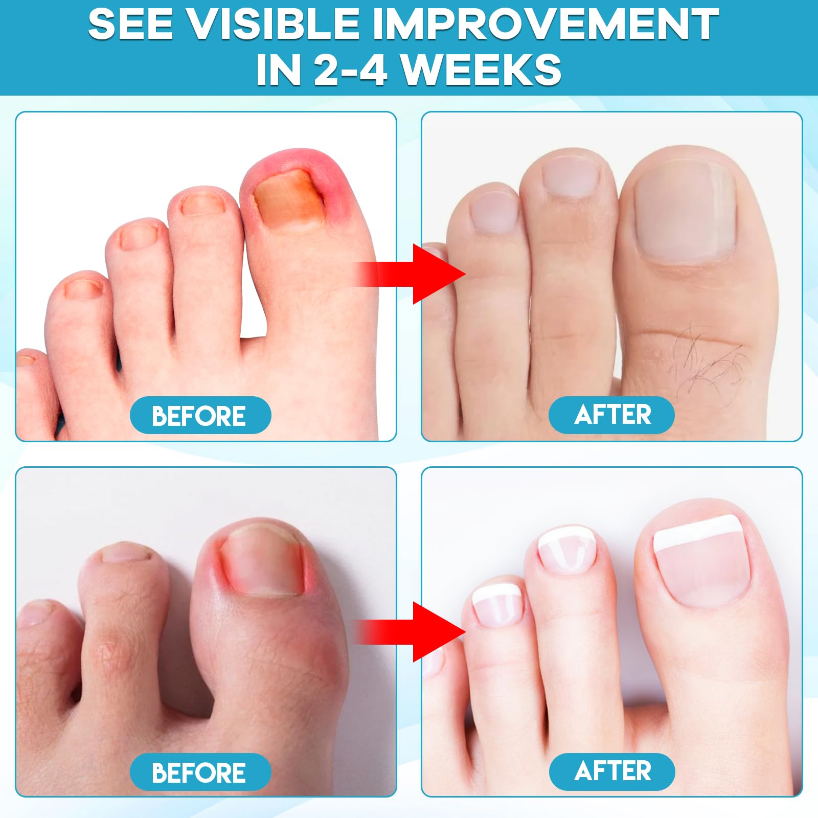 Maliyscent Ingrown Toenail Drop at-home care routine for daily use