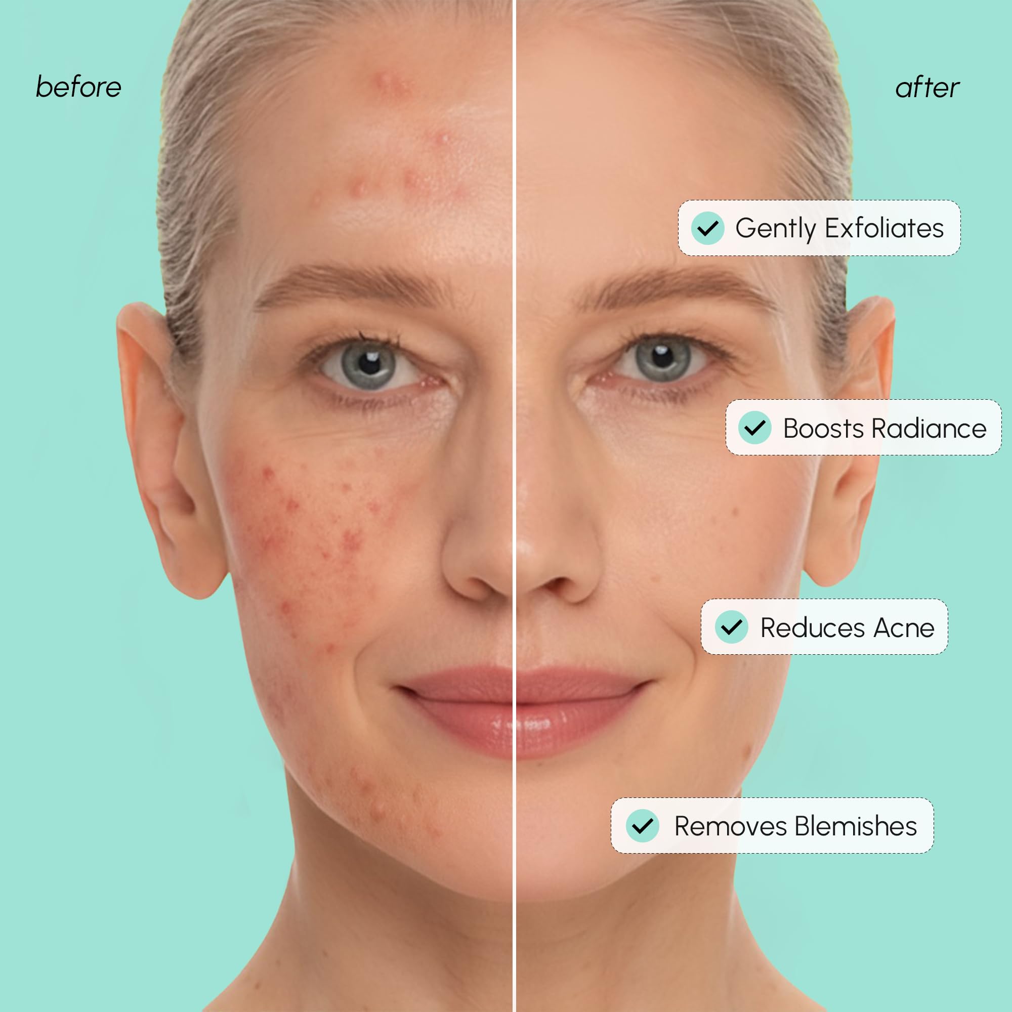 MAREE glycolic-acid-pad-surface-closeup emphasizes brightening texture.