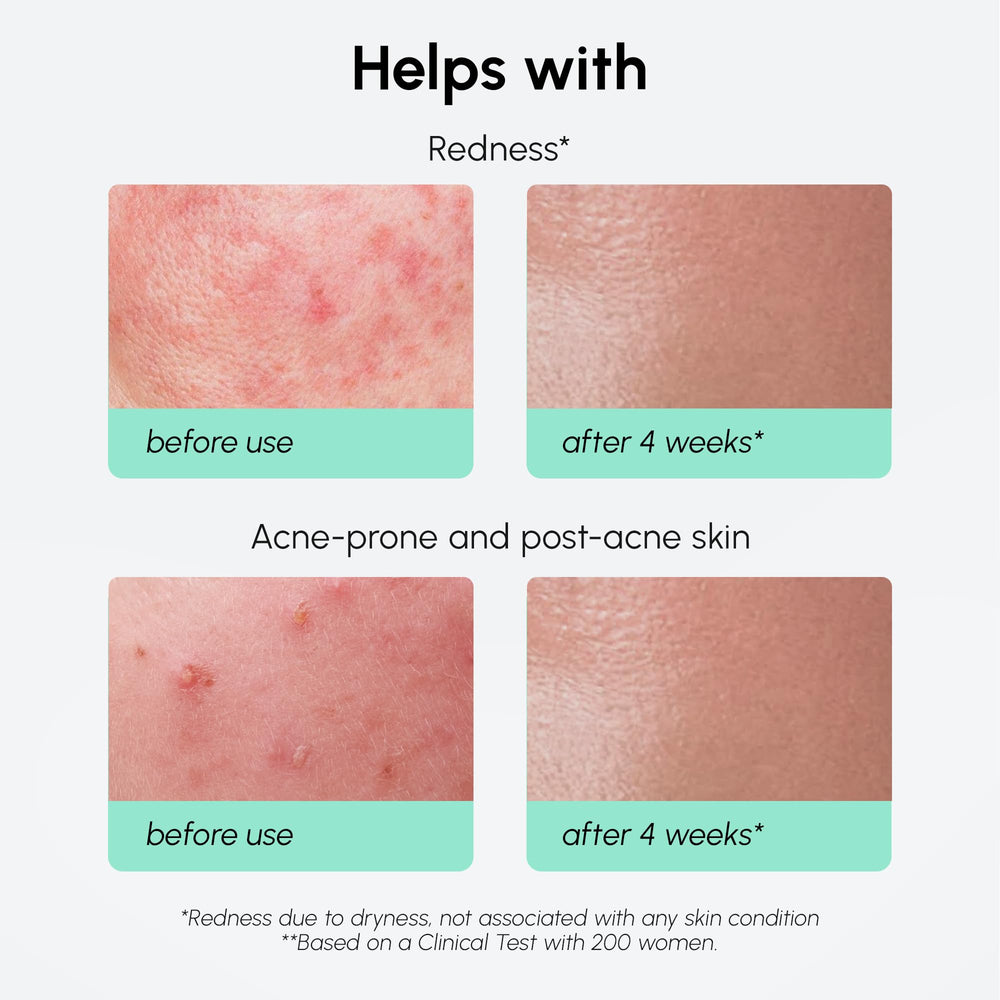 MAREE niacinamide-centella-hyaluronic ingredients highlight calming, moisture-balancing care.