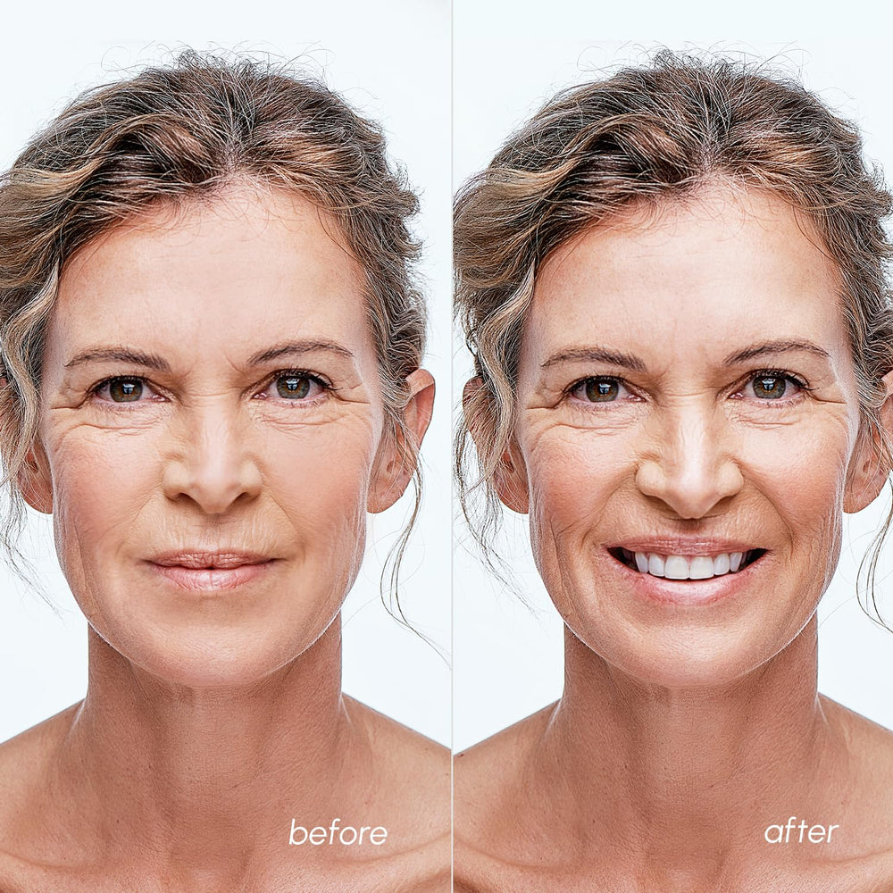 MAREE salicylic acid exfoliating pad demonstrating gentle acne care routine.