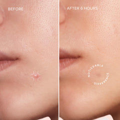 MAREE Star patch with tea tree oil for gentle soothing