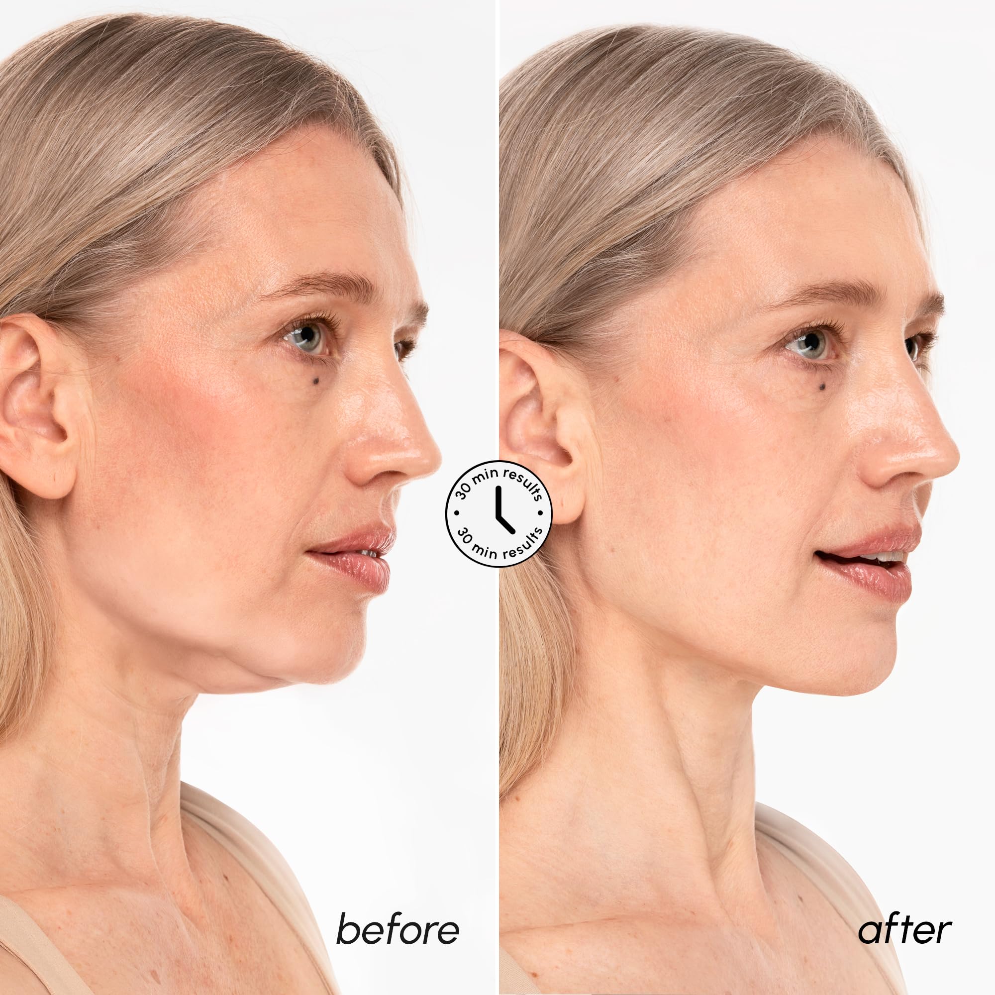 MAREE V Line mask hydrogel texture hugs the face for comfortable wear