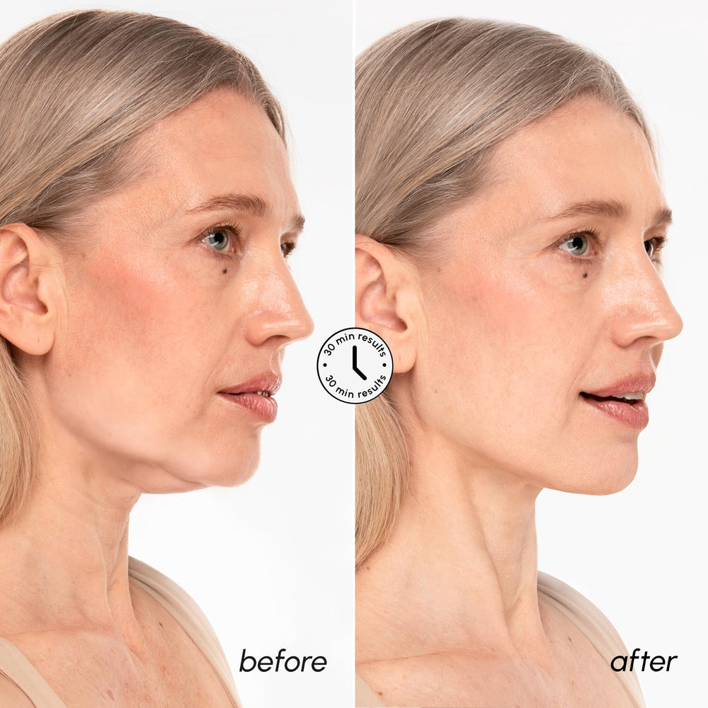 MAREE V Line mask hydrogel texture hugs the face for comfortable wear