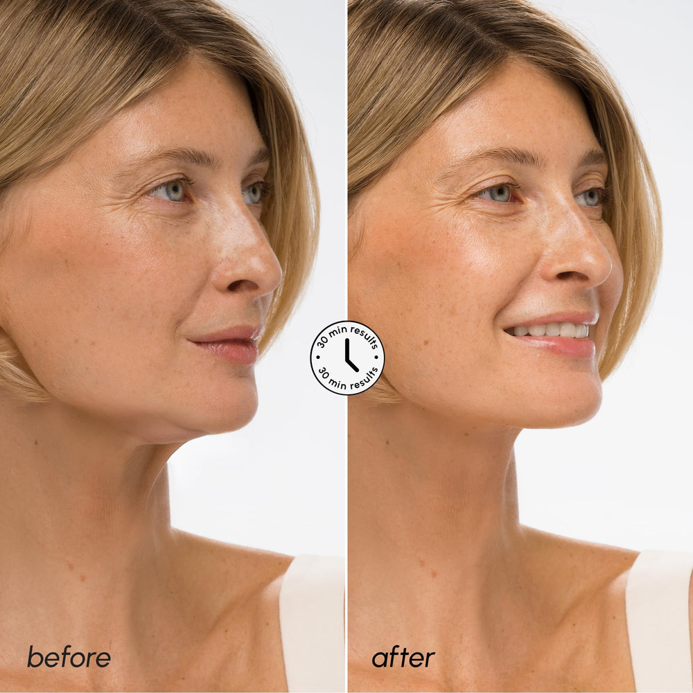 MAREE V Line Lifting Mask jawline-contour-shot illustrating sculpted look and contour support