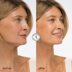 MAREE V Line Lifting Mask jawline-contour-shot illustrating sculpted look and contour support