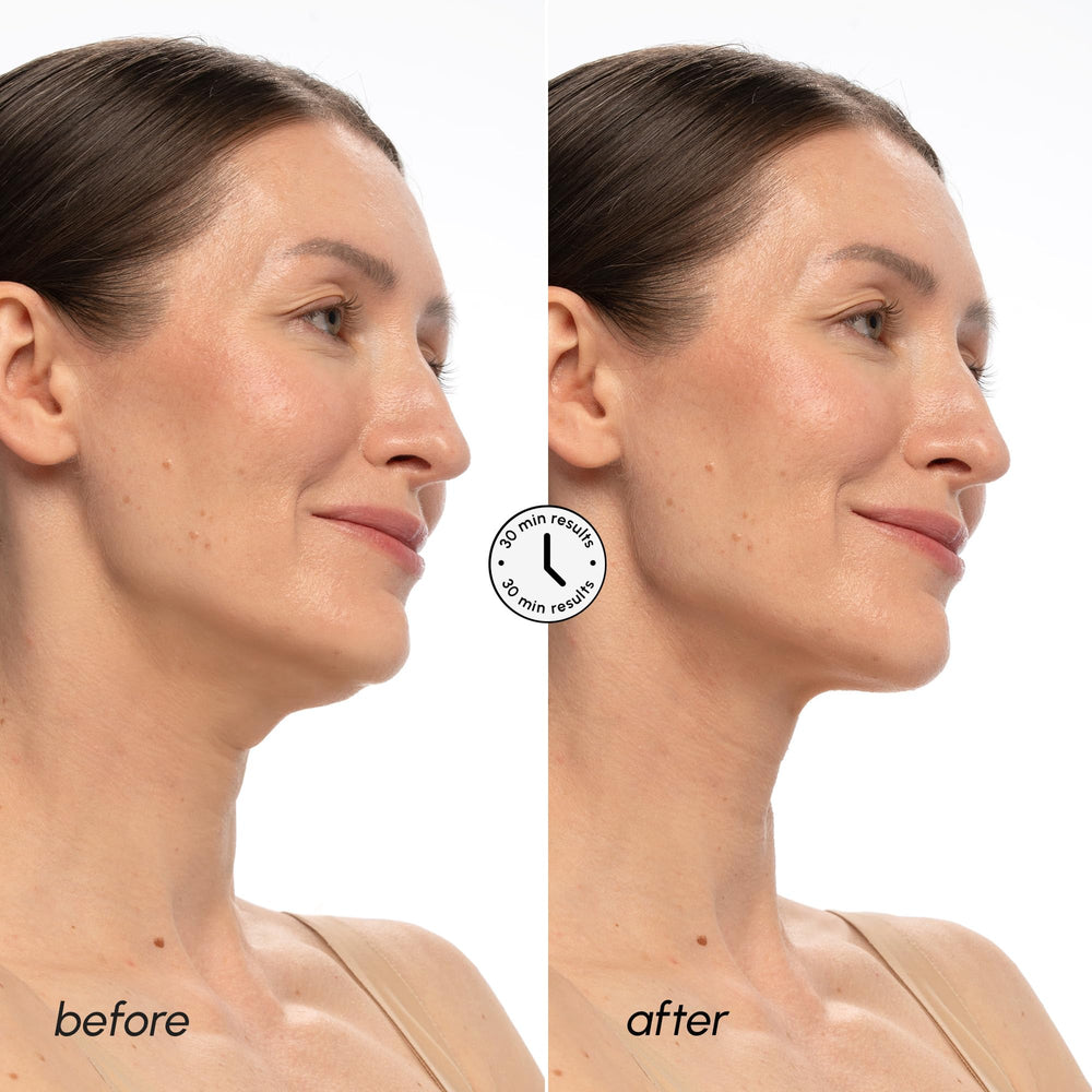 MAREE V Line Mask neck-tightening application brings a gentle lift