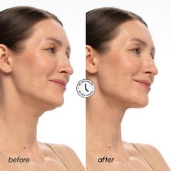 MAREE V Line Mask neck-tightening application brings a gentle lift