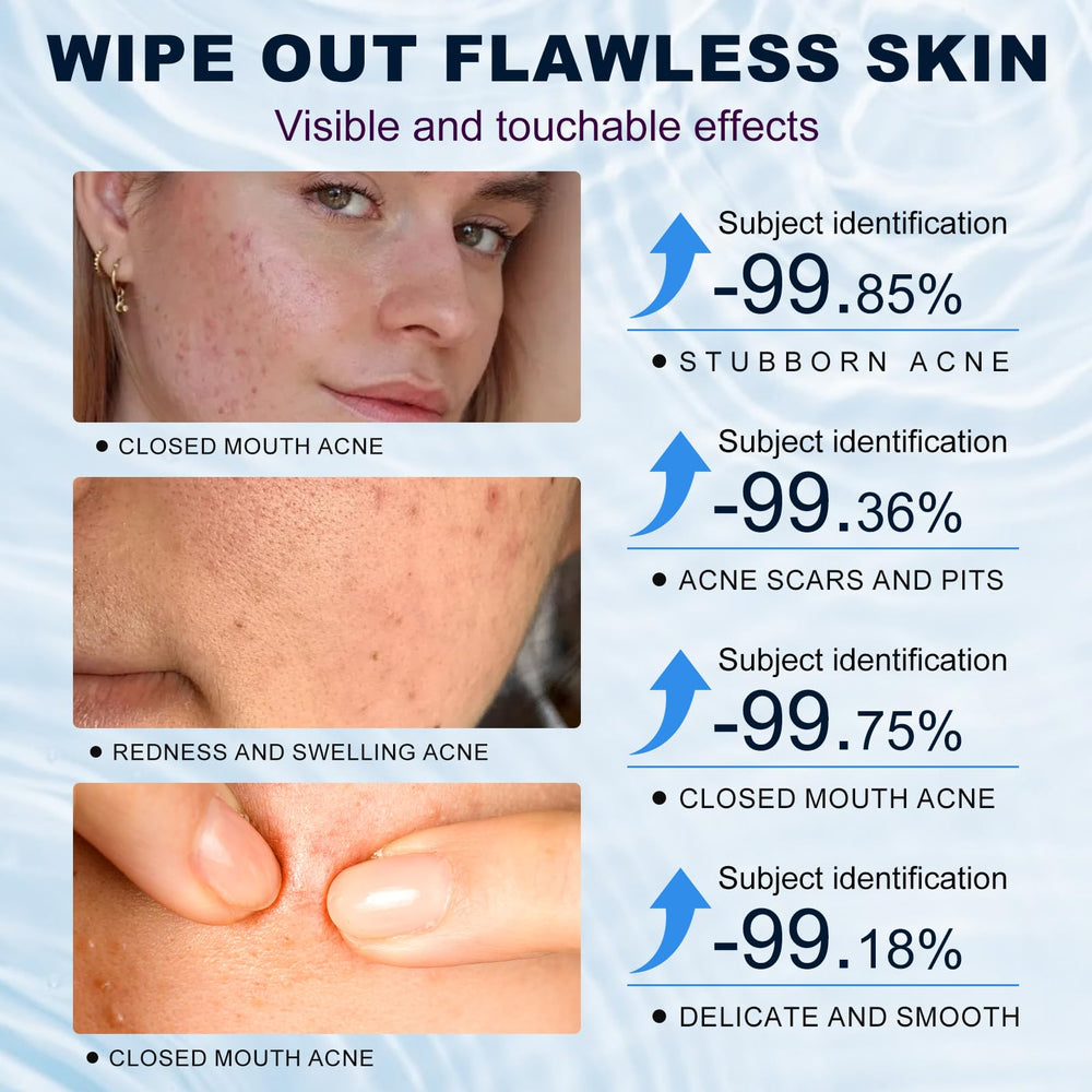Marianp Azelaic Acid Cream ingredient drops illustrate active formula.