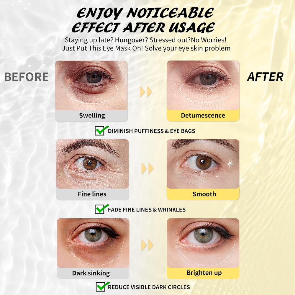 Maskiss 24K gold masks smoothing wrinkles and boosting elasticity.